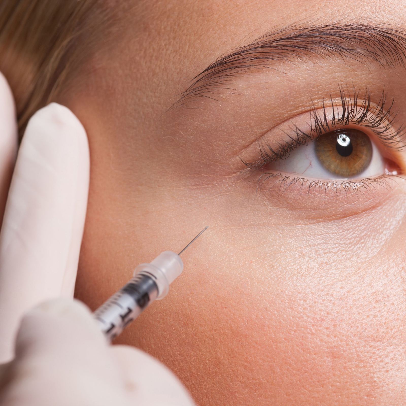 Injectable treatment beneath the eye, close up
