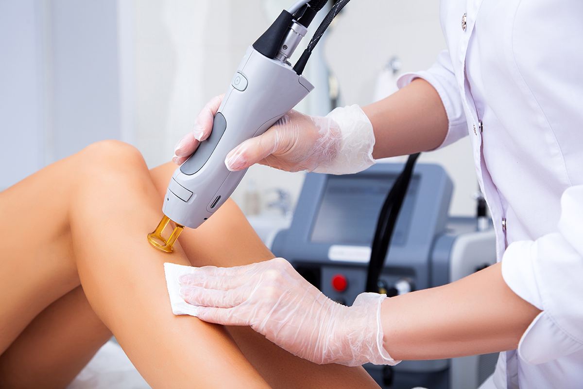 Laser hair removal being performed on the leg